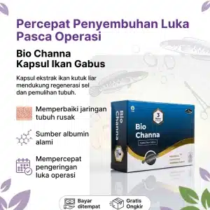 Bio Channa Kapsul Ikan Gabus